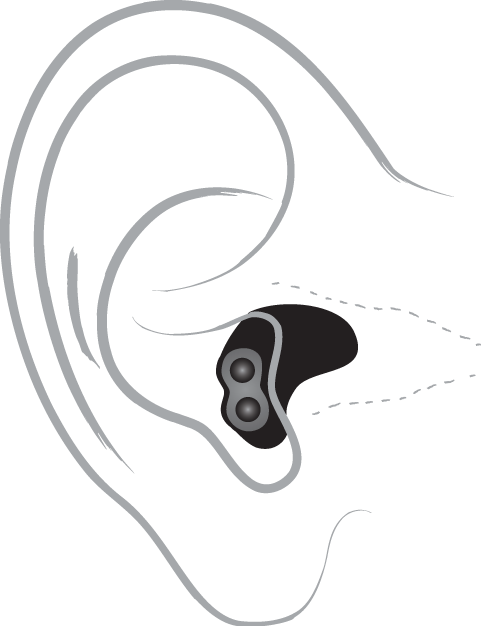 Completely in the canal hearing aid diagram