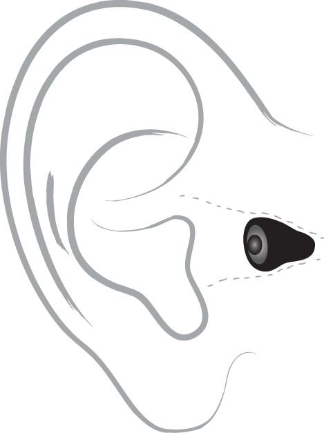 Invisible hearing aid diagram